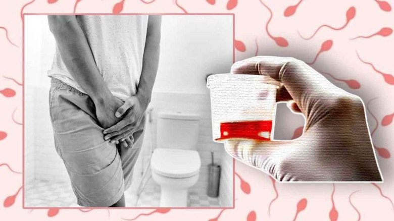 প্রস্রাবের সঙ্গে শ্বেতস্রাব?—কিডনি বিকল হওয়ার লক্ষণ নয় তো?...