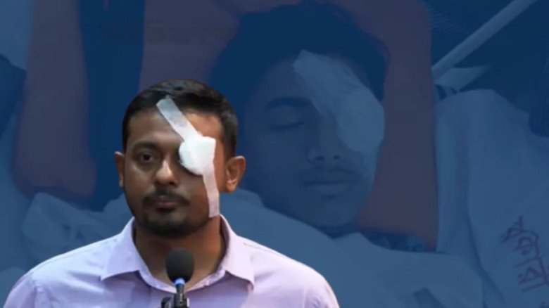 আহত আলিফের প্রতি সহমর্মিতা জানিয়ে চোখে ব্যান্ডেজ পরে বক্তব্য